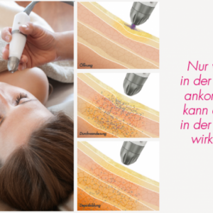 TDA Behandlung